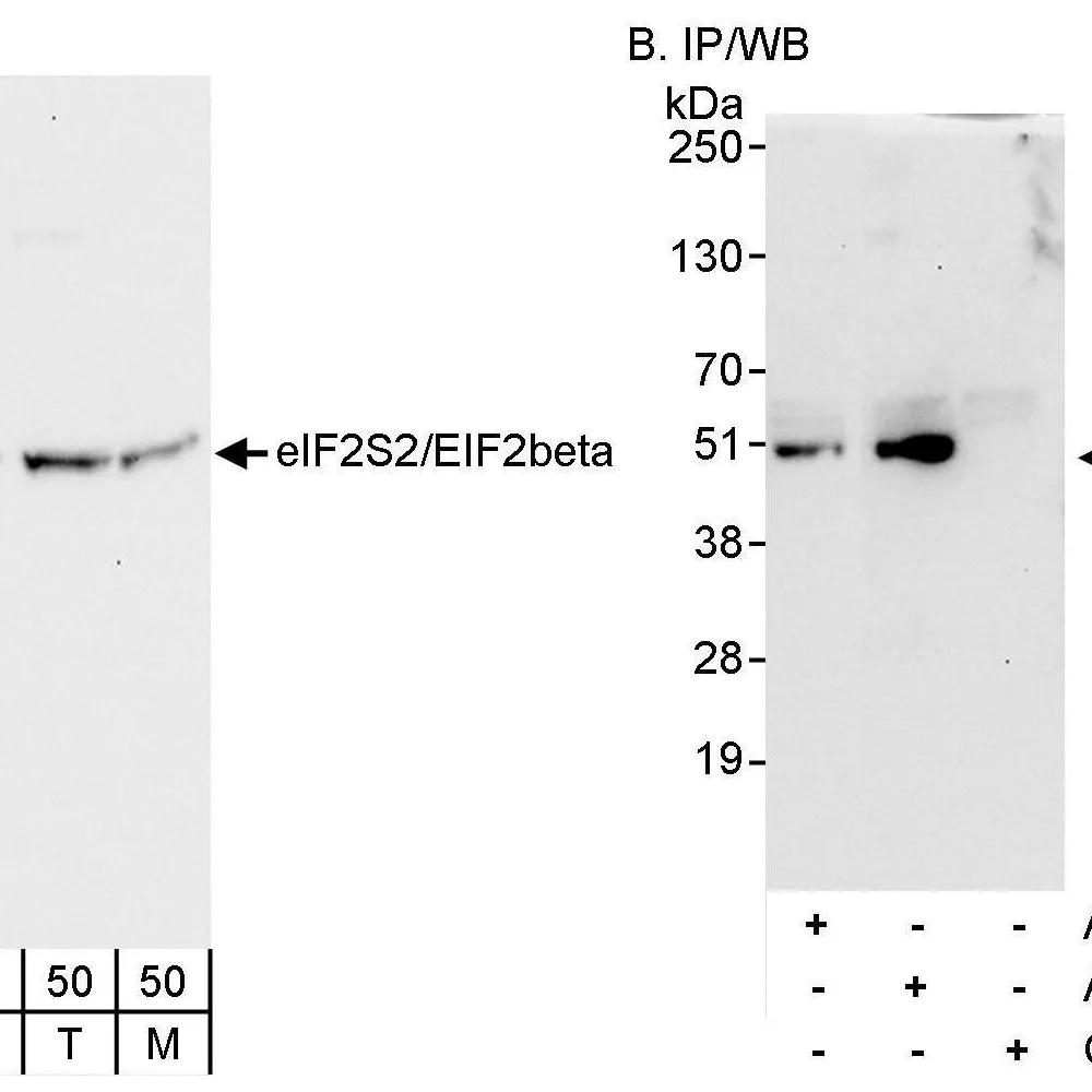 Rabbit anti-eIF2beta/EIF2S2 Antibody, Affinity Purified