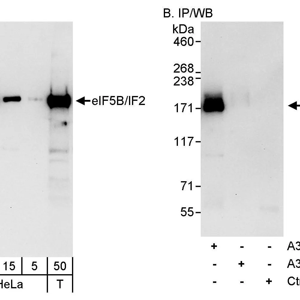 Rabbit anti-eIF5B/IF2 Antibody, Affinity Purified