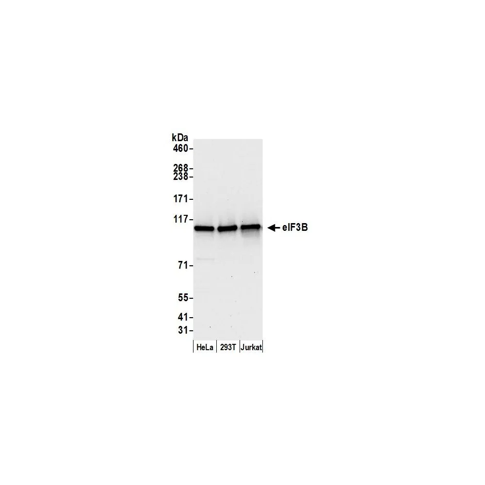 Rabbit anti-eIF3B/EIF3S9 Antibody, Affinity Purified