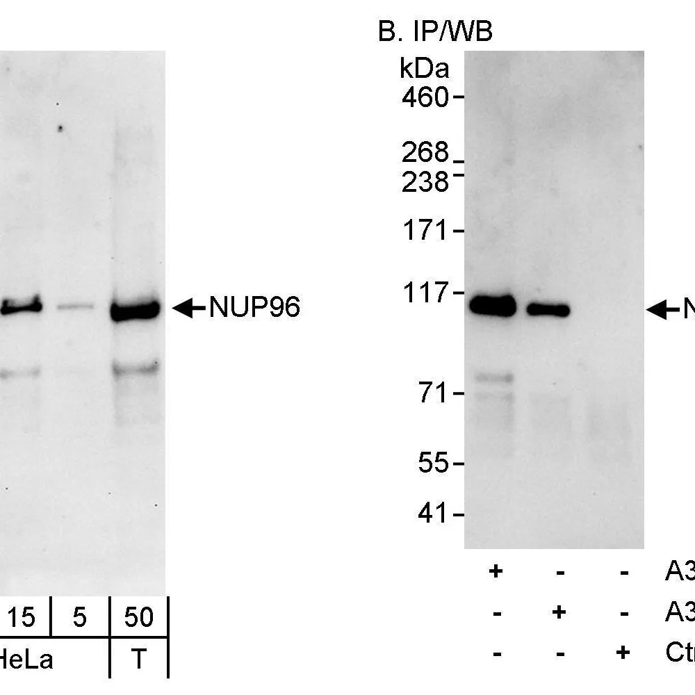 Rabbit anti-NUP96 Antibody, Affinity Purified