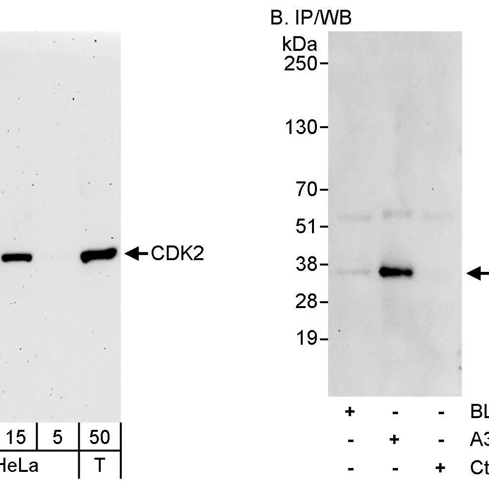 Rabbit anti-CDK2 Antibody, Affinity Purified