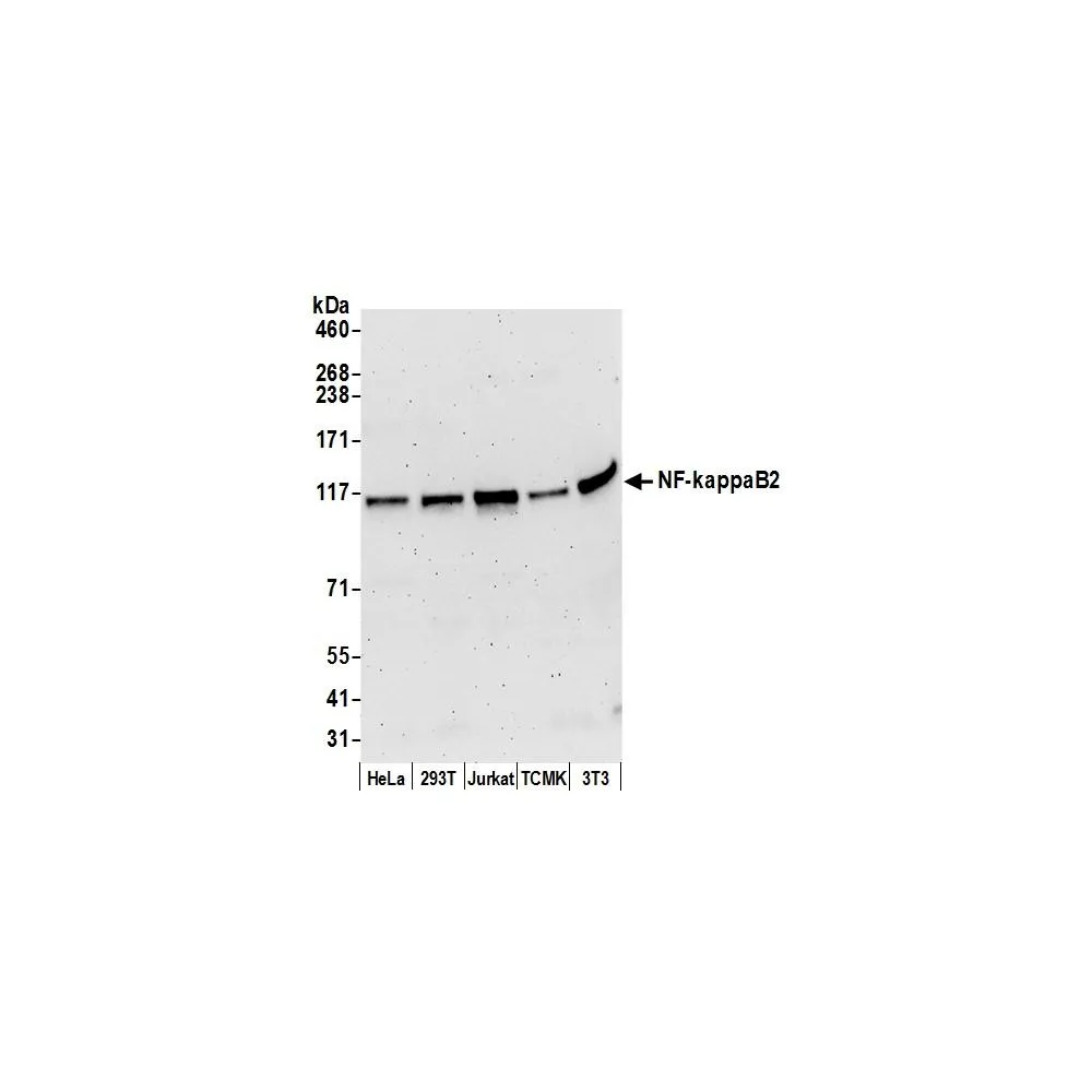 Rabbit anti-NF-kappaB2 Antibody, Affinity Purified