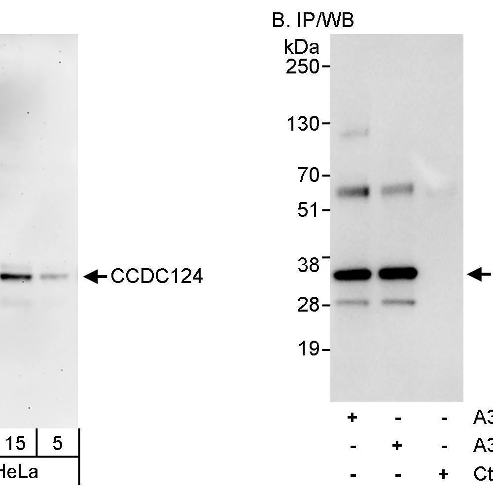 Rabbit anti-CCDC124 Antibody, Affinity Purified