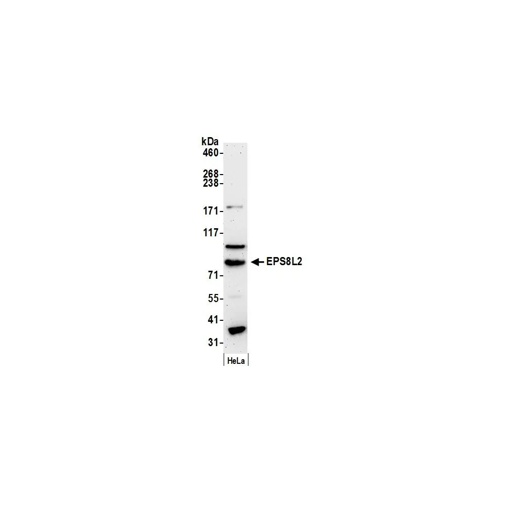 Rabbit anti-EPS8L2 Antibody, Affinity Purified