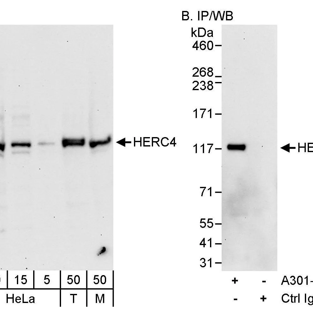 Rabbit anti-HERC4 Antibody, Affinity Purified