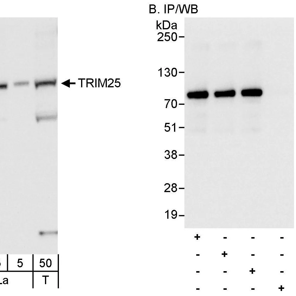 Rabbit anti-TRIM25 Antibody, Affinity Purified