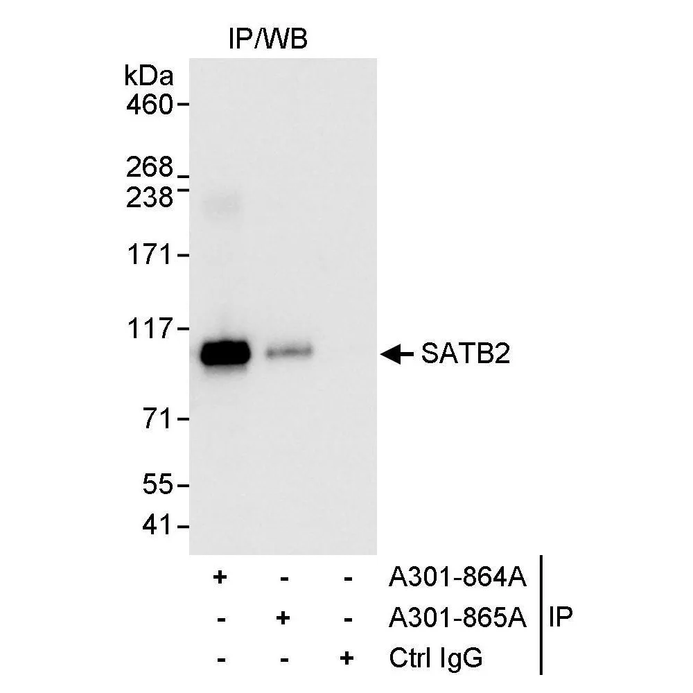 Rabbit anti-SATB2 Antibody, Affinity Purified
