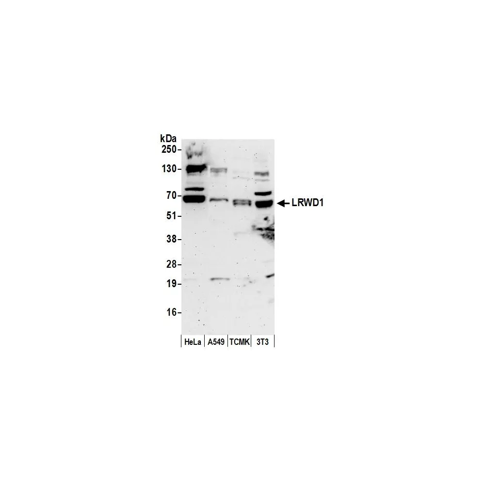 Rabbit anti-LRWD1 Antibody, Affinity Purified