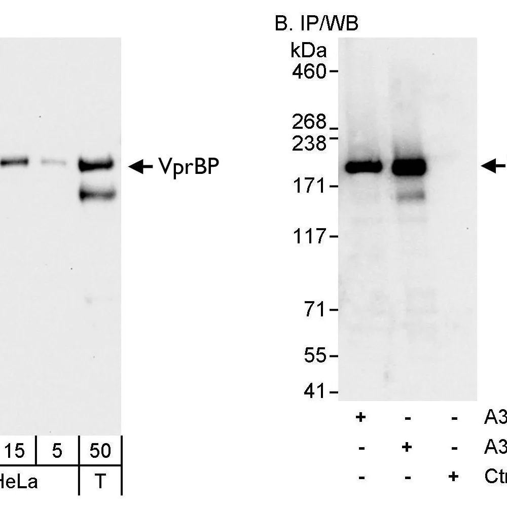 Rabbit anti-VprBP Antibody, Affinity Purified
