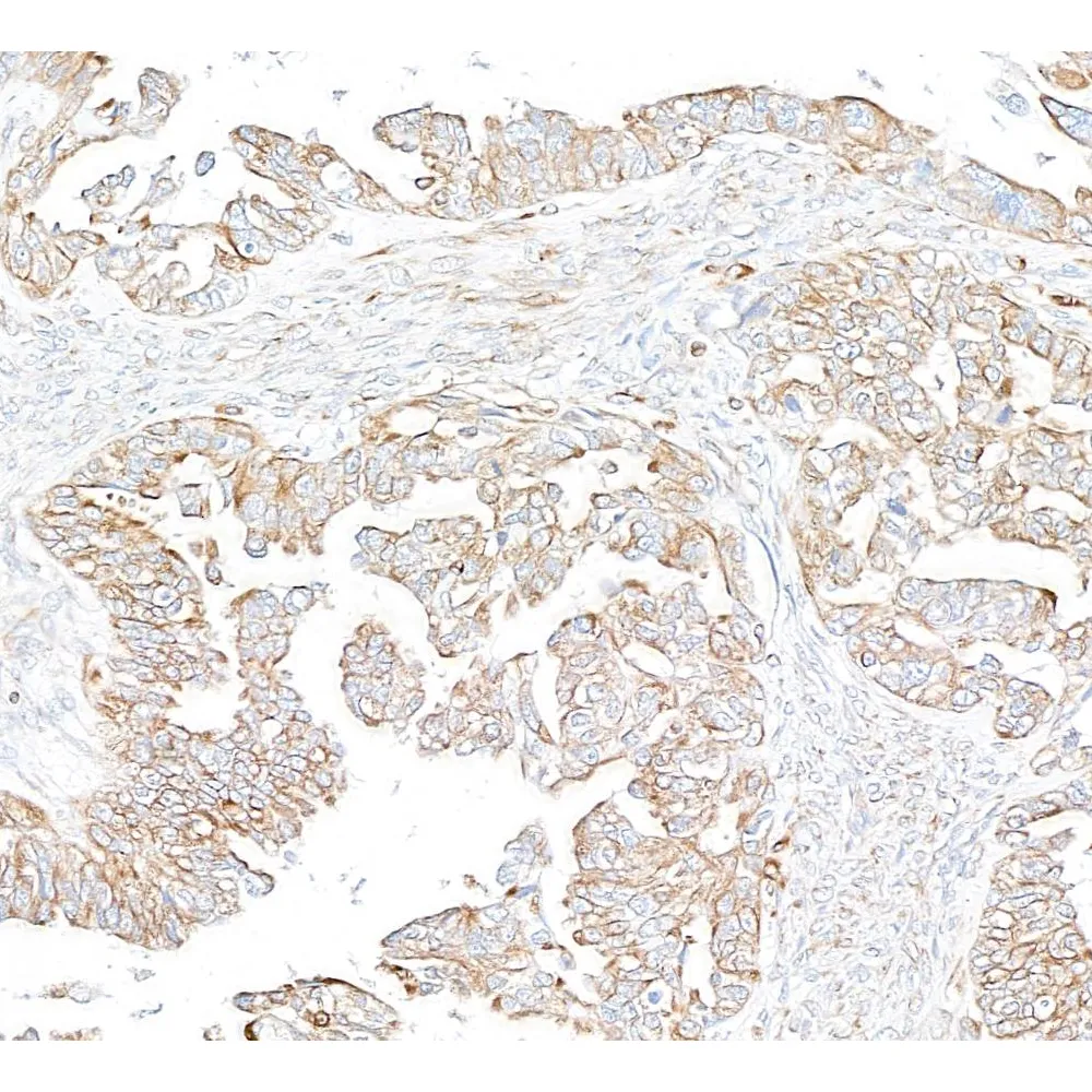 Rabbit anti-EML4 Antibody, Affinity Purified