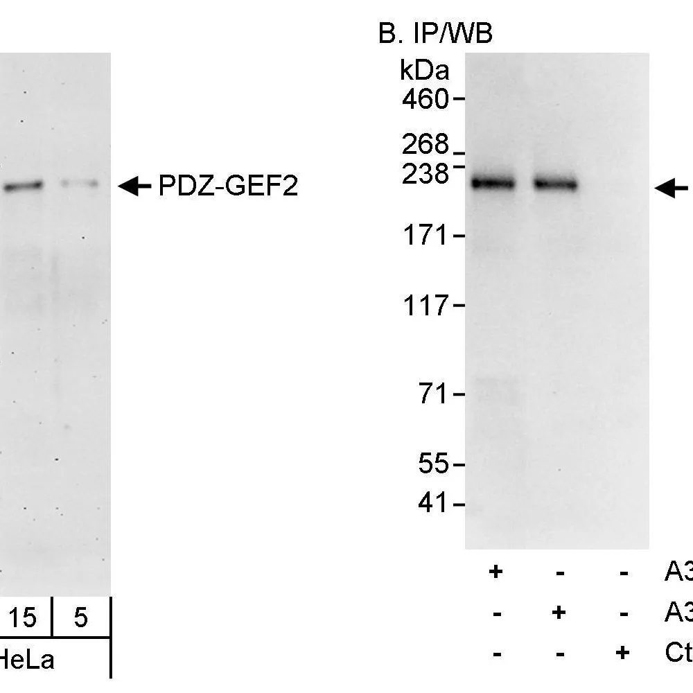 Rabbit anti-PDZ-GEF2 Antibody, Affinity Purified
