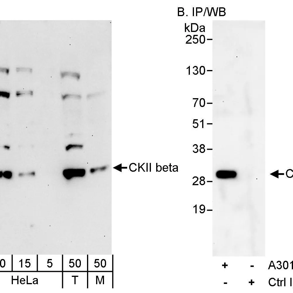 Rabbit anti-CKII beta Antibody, Affinity Purified