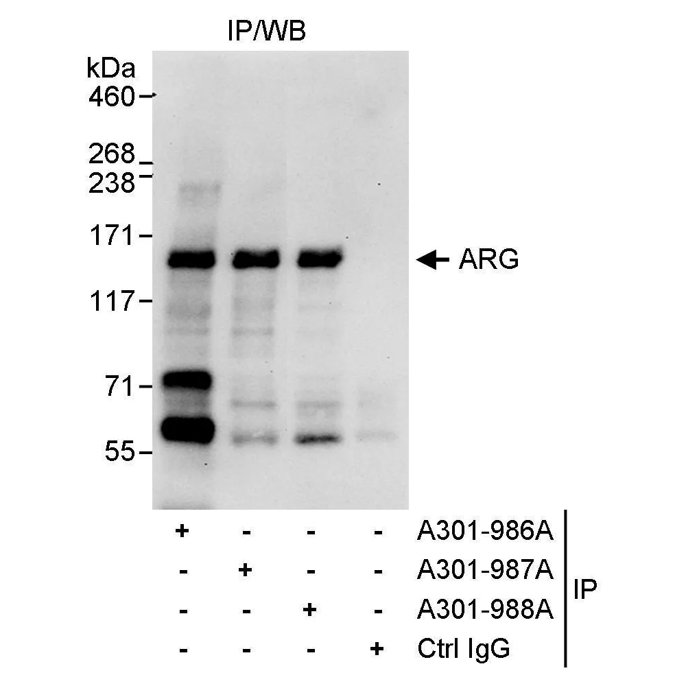 Rabbit anti-ARG Antibody, Affinity Purified