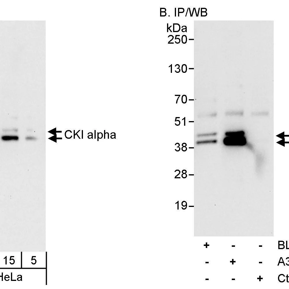 Rabbit anti-CKI alpha Antibody, Affinity Purified