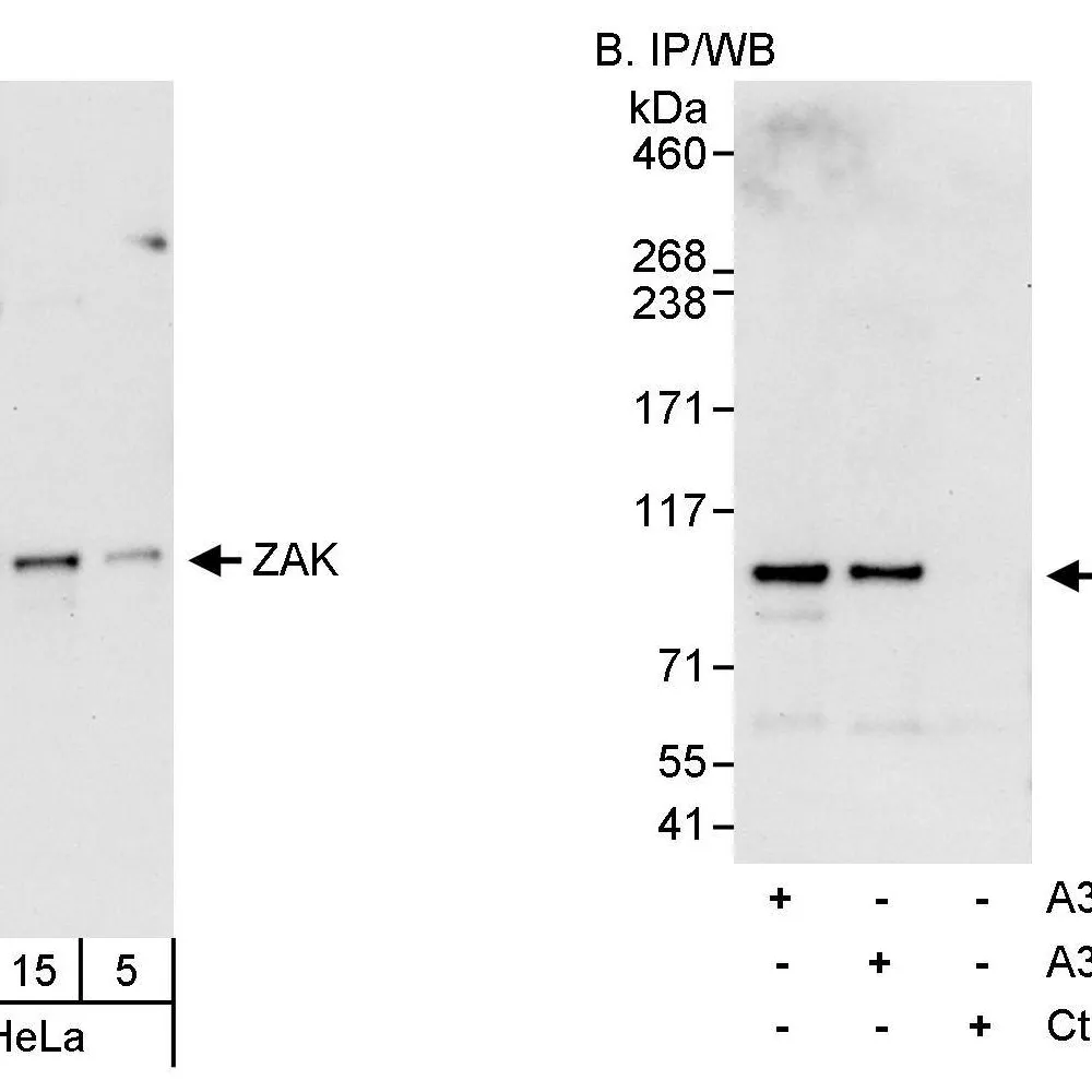 Rabbit anti-ZAK Antibody, Affinity Purified