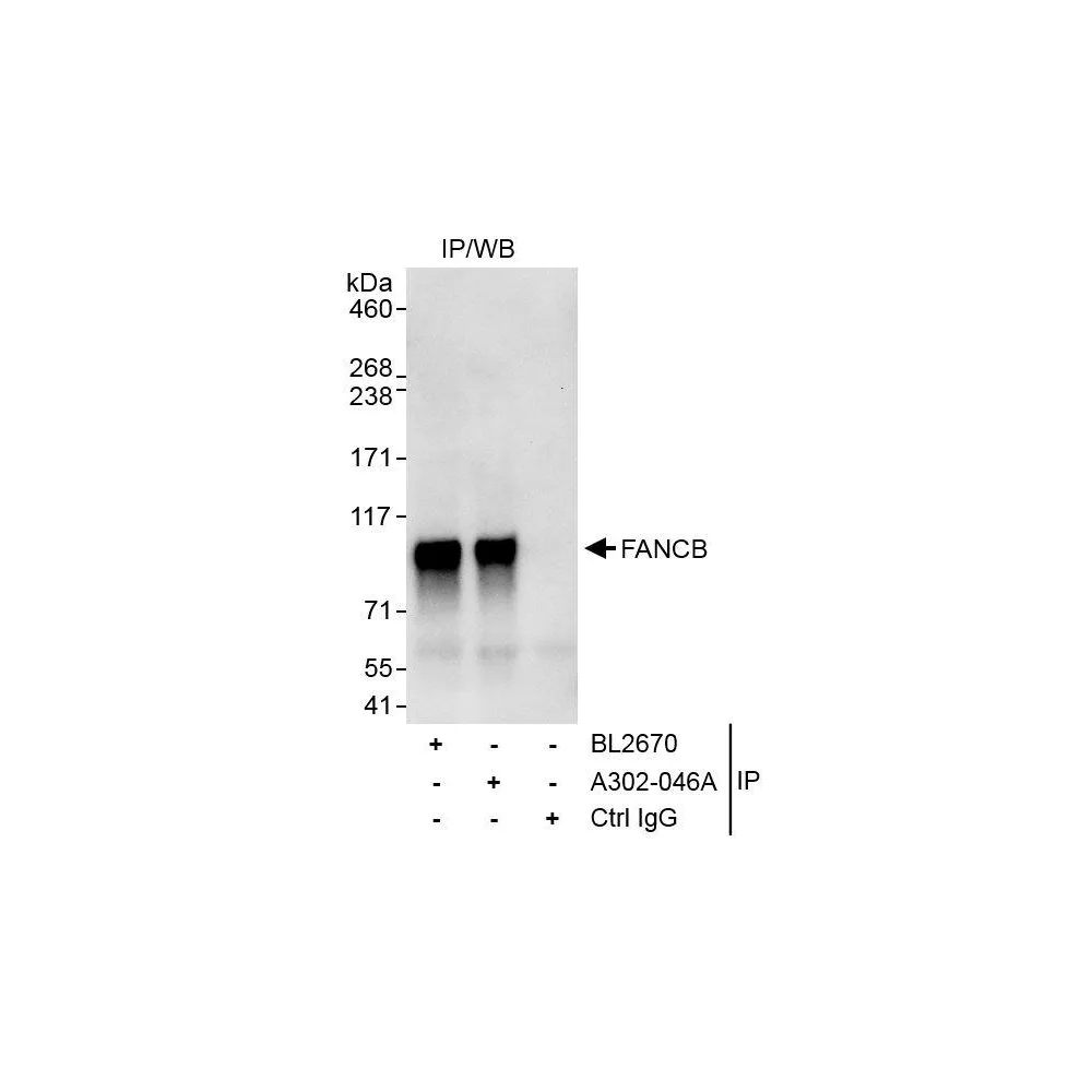 Rabbit anti-FANCB Antibody, Affinity Purified