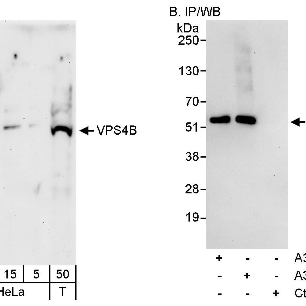 Rabbit anti-VPS4B Antibody, Affinity Purified