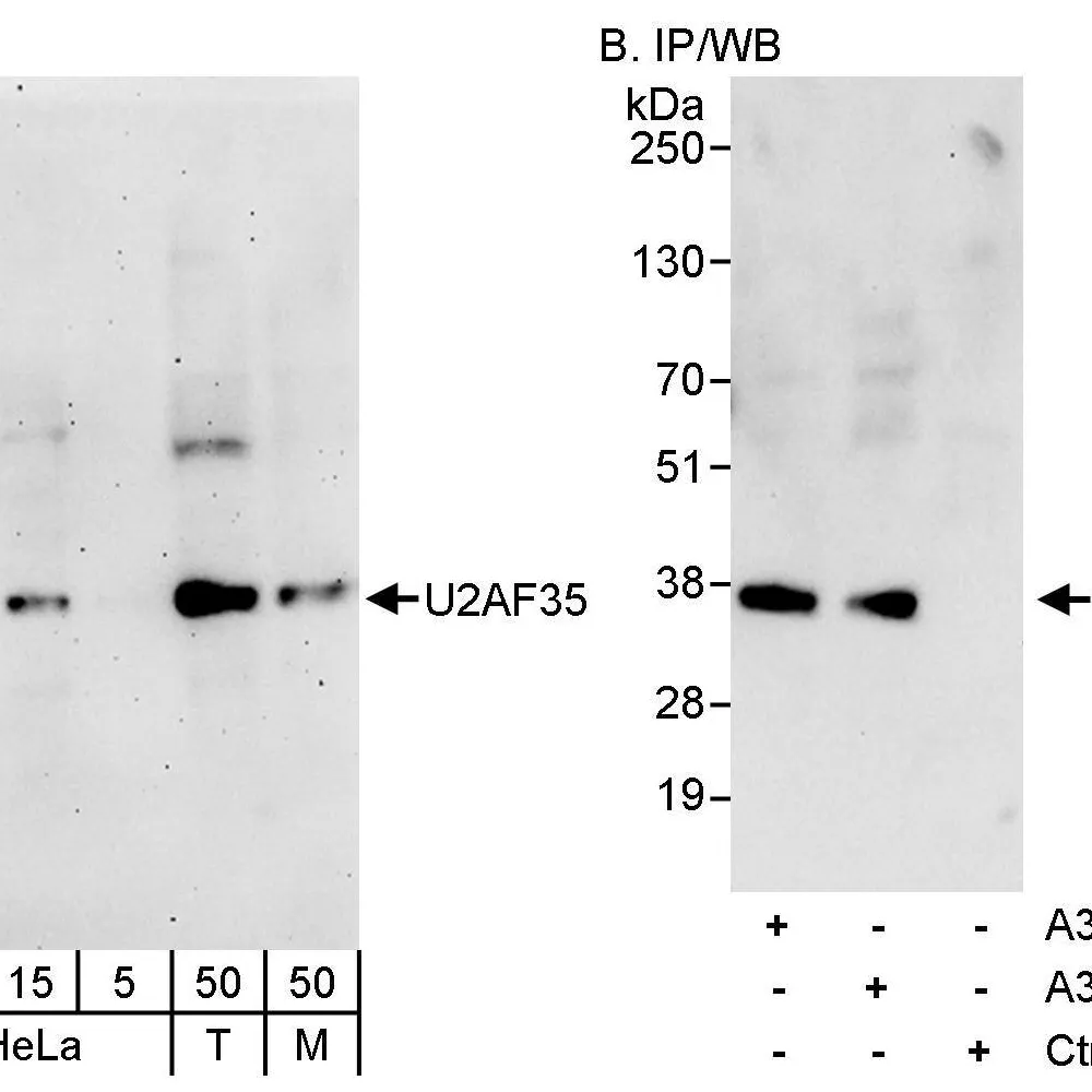 Rabbit anti-U2AF35 Antibody, Affinity Purified