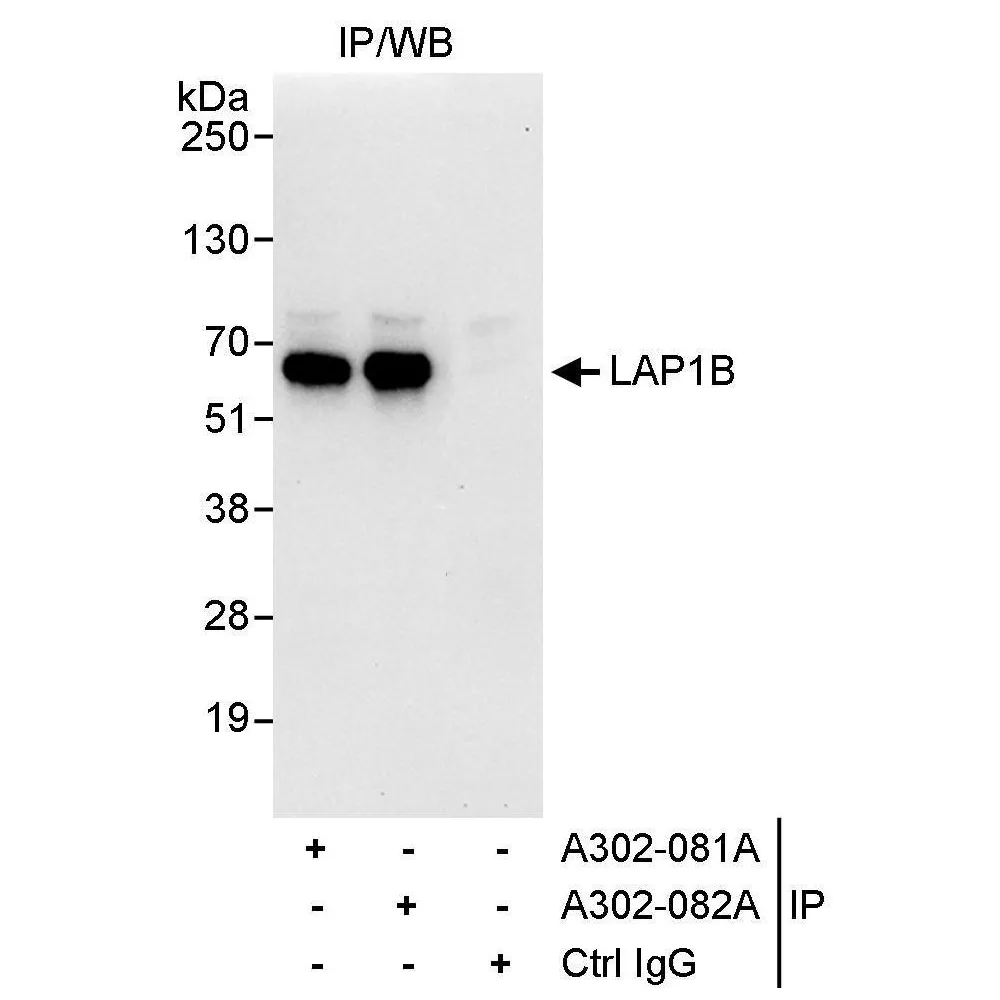 Rabbit anti-LAP1B Antibody, Affinity Purified