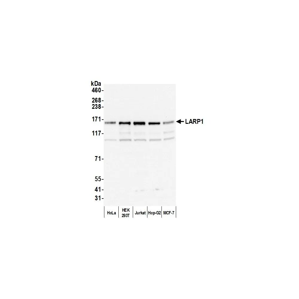 Rabbit anti-LARP1 Antibody, Affinity Purified