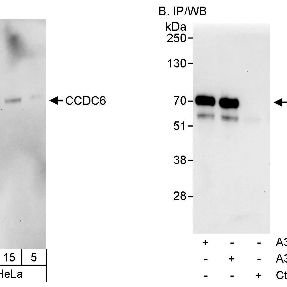 Rabbit anti-CCDC6 Antibody, Affinity Purified