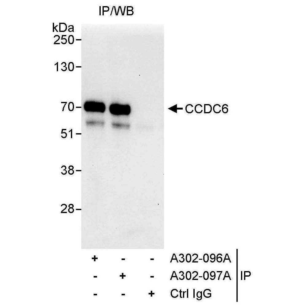 Rabbit anti-CCDC6 Antibody, Affinity Purified