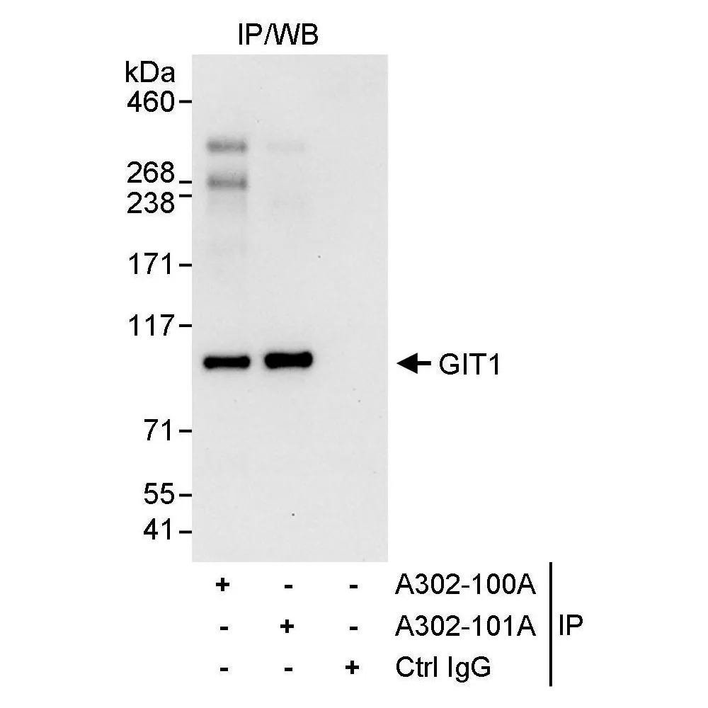 Rabbit anti-GIT1 Antibody, Affinity Purified
