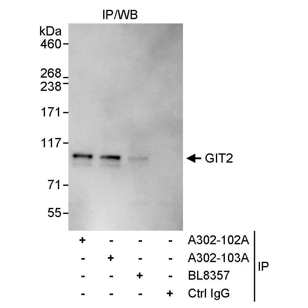 Rabbit anti-GIT2 Antibody, Affinity Purified