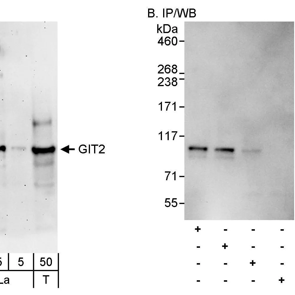 Rabbit anti-GIT2 Antibody, Affinity Purified
