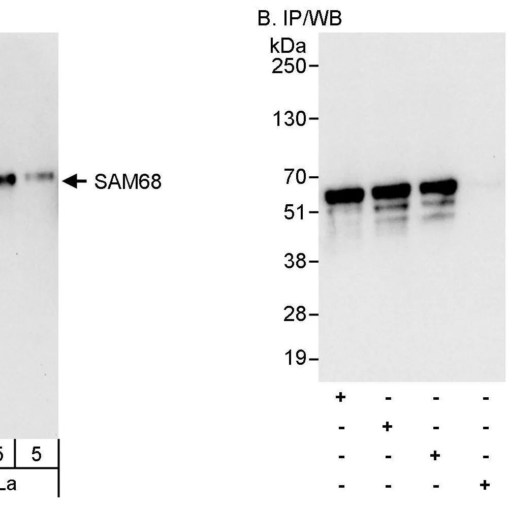 Rabbit anti-SAM68 Antibody, Affinity Purified