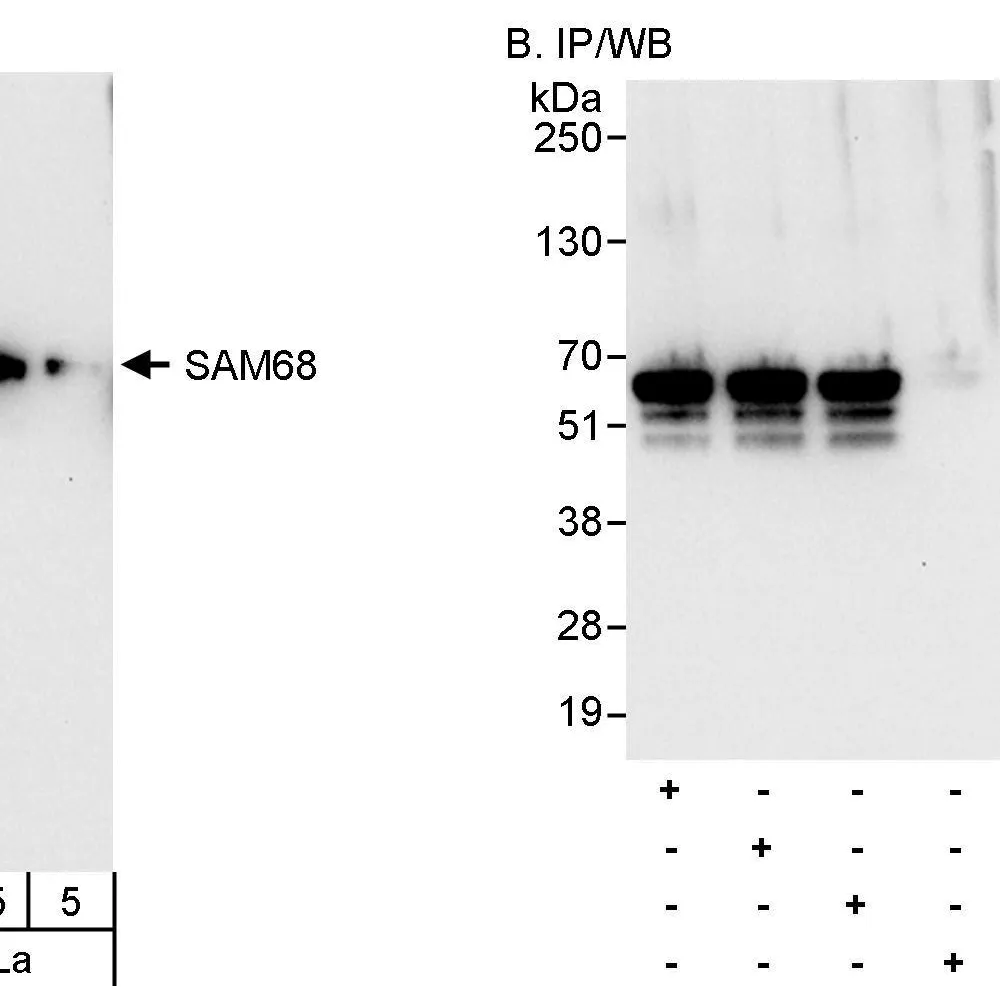 Rabbit anti-SAM68 Antibody, Affinity Purified