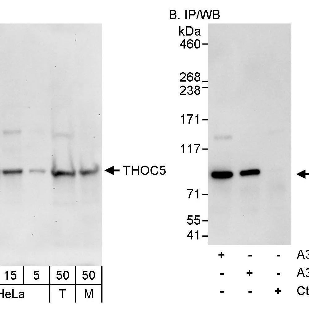 Rabbit anti-THOC5 Antibody, Affinity Purified