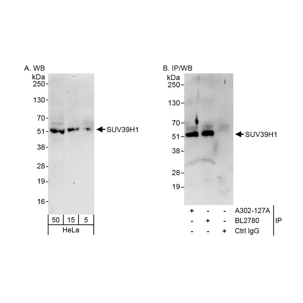 Rabbit anti-SUV39H1 Antibody, Affinity Purified