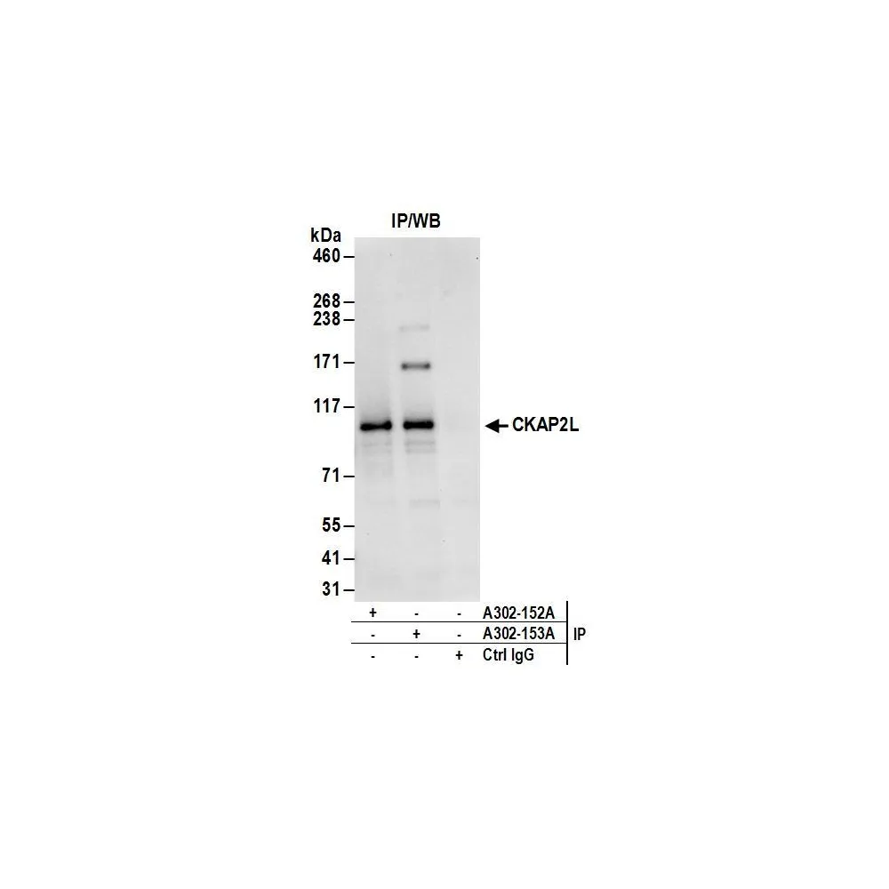 Rabbit anti-CKAP2L Antibody, Affinity Purified