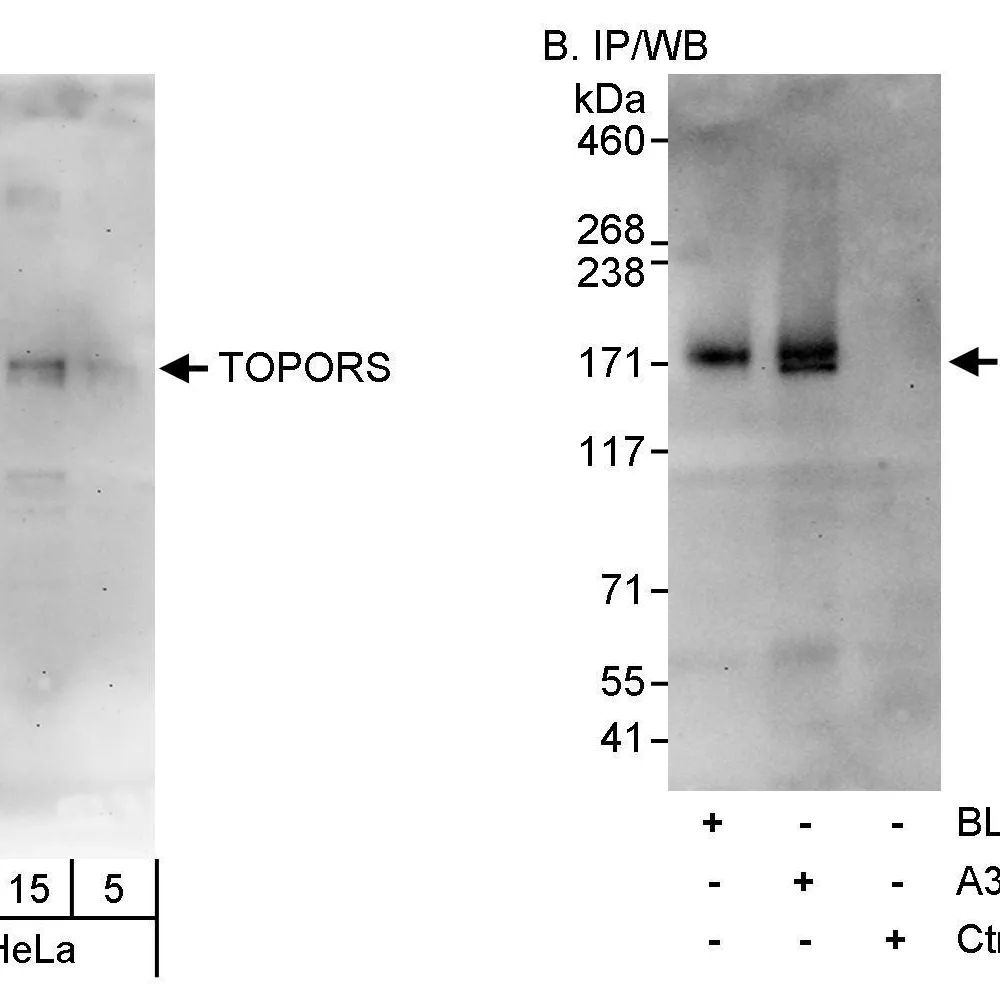 Rabbit anti-TOPORS Antibody, Affinity Purified