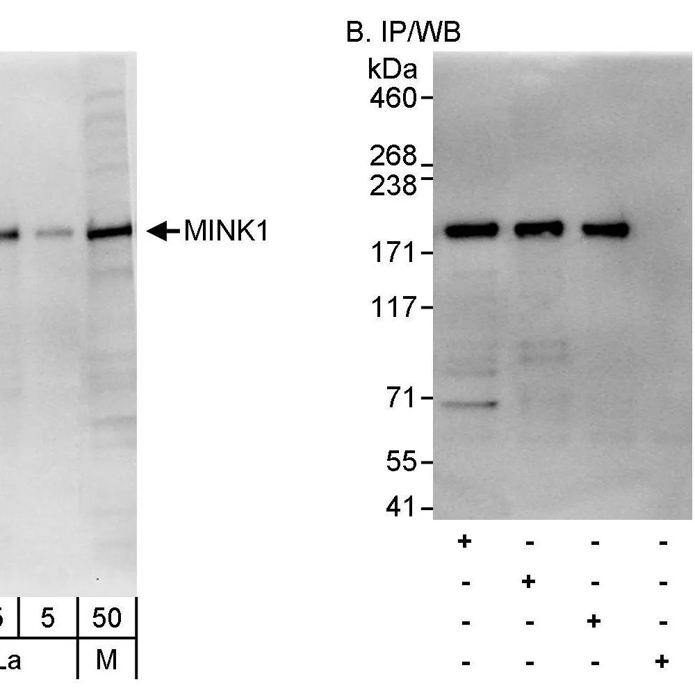 Rabbit anti-MINK1 Antibody, Affinity Purified