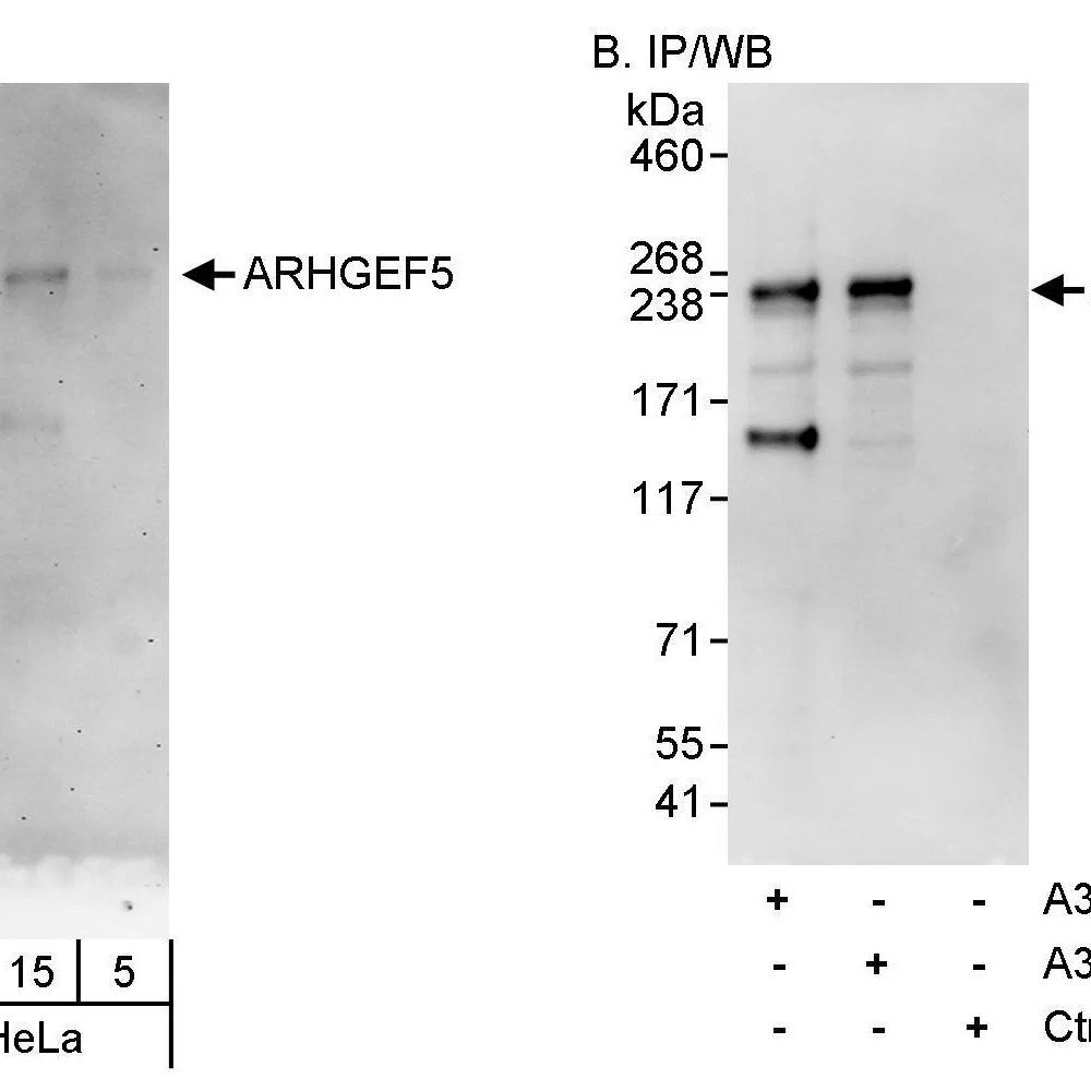 Rabbit anti-ARHGEF5 Antibody, Affinity Purified