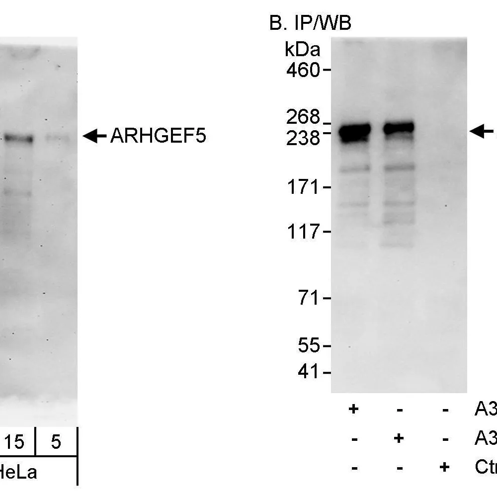 Rabbit anti-ARHGEF5 Antibody, Affinity Purified