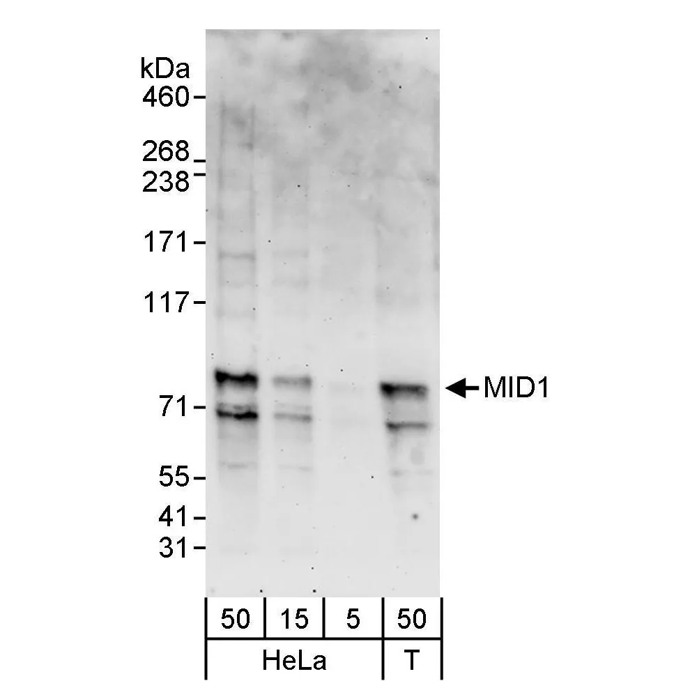 Rabbit anti-MID1 Antibody, Affinity Purified