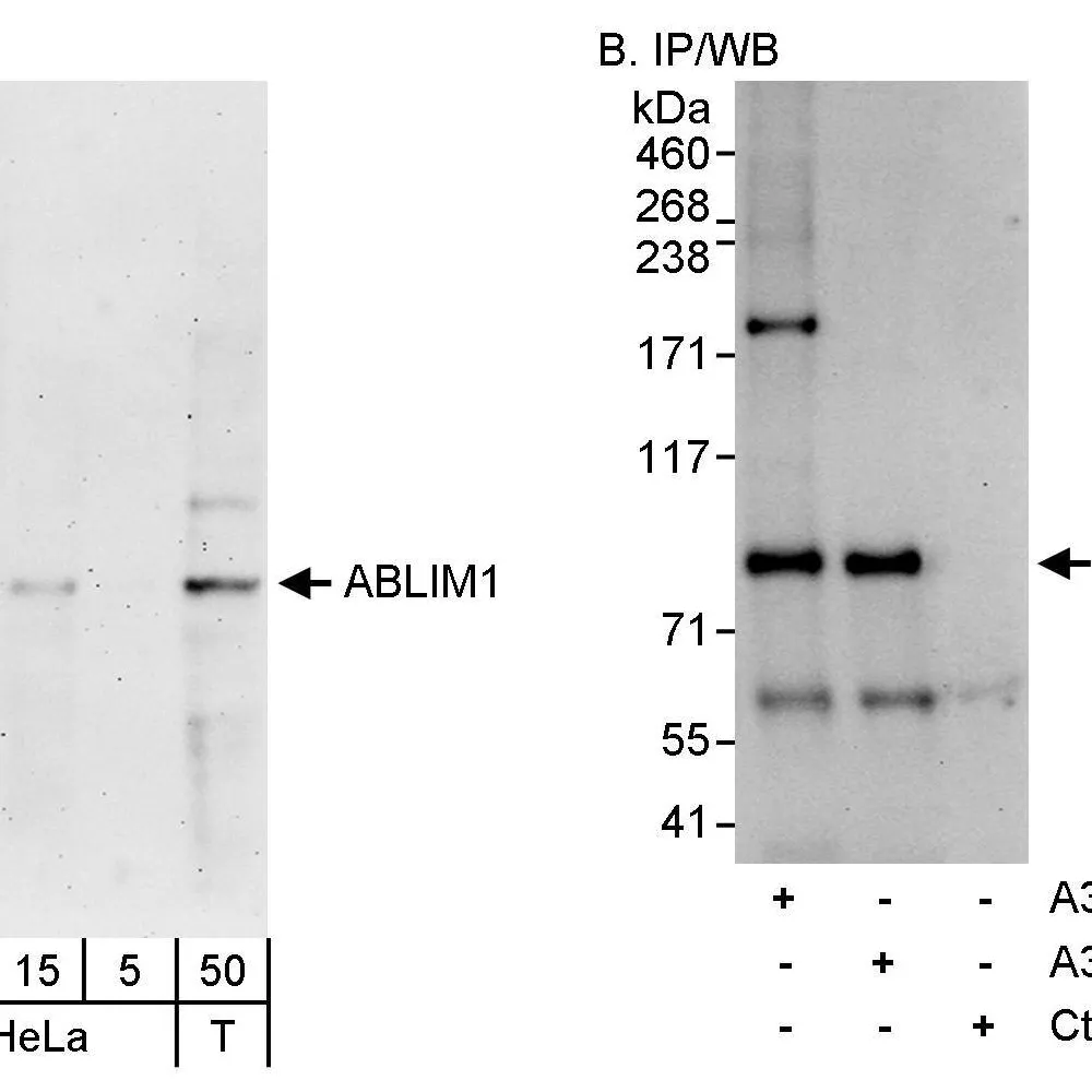 Rabbit anti-ABLIM1 Antibody, Affinity Purified