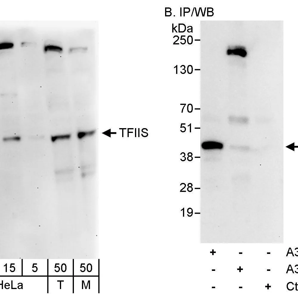 Rabbit anti-TFIIS Antibody, Affinity Purified