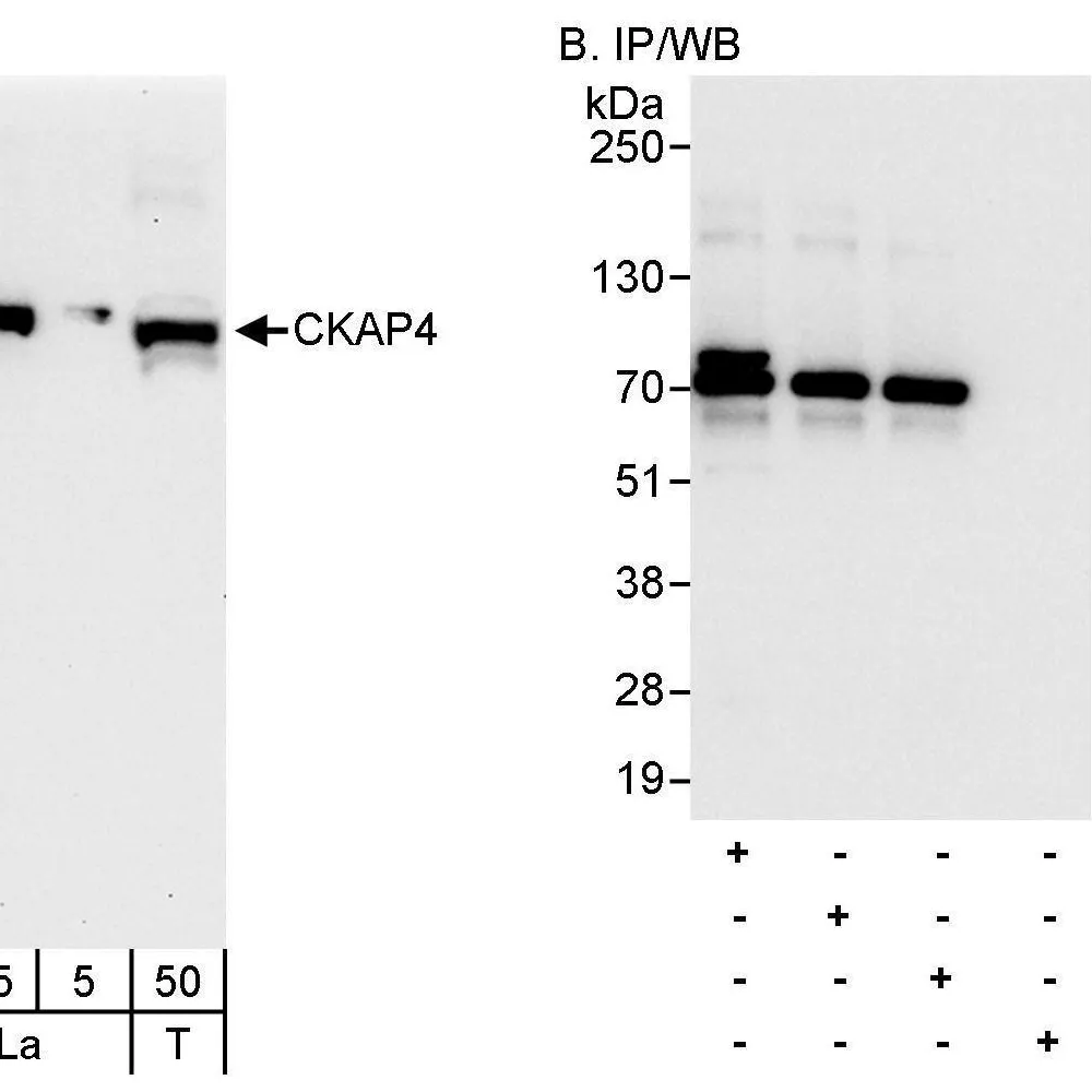 Rabbit anti-CKAP4 Antibody, Affinity Purified