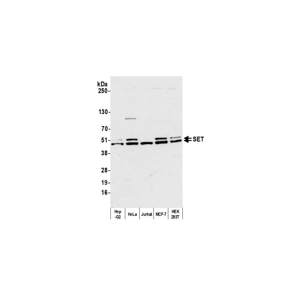 Rabbit anti-SET Antibody, Affinity Purified