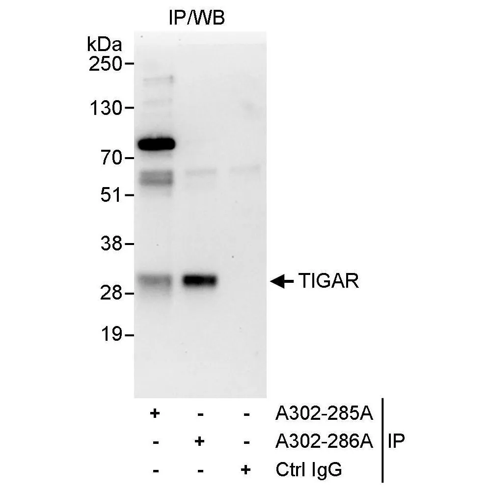 Rabbit anti-TIGAR Antibody, Affinity Purified