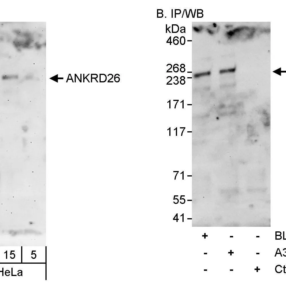 Rabbit anti-ANKRD26 Antibody, Affinity Purified