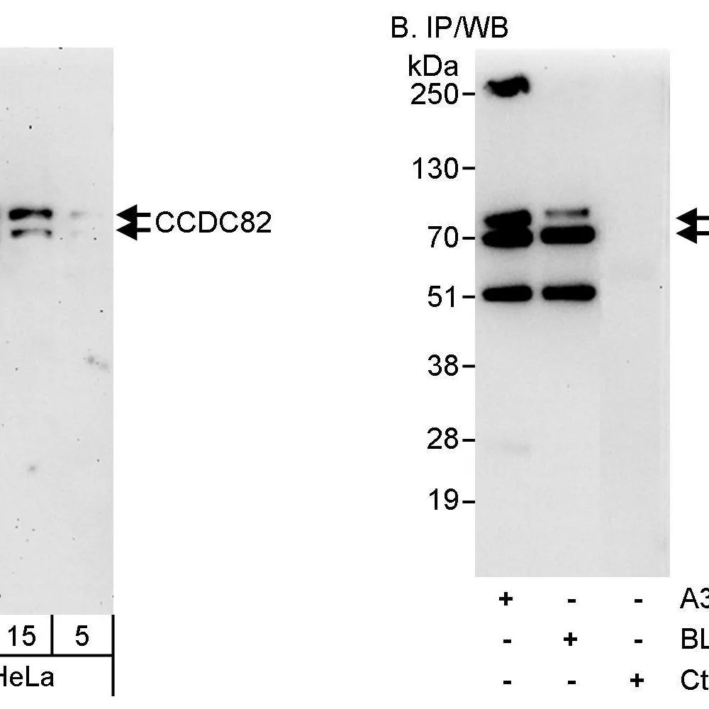 Rabbit anti-CCDC82 Antibody, Affinity Purified