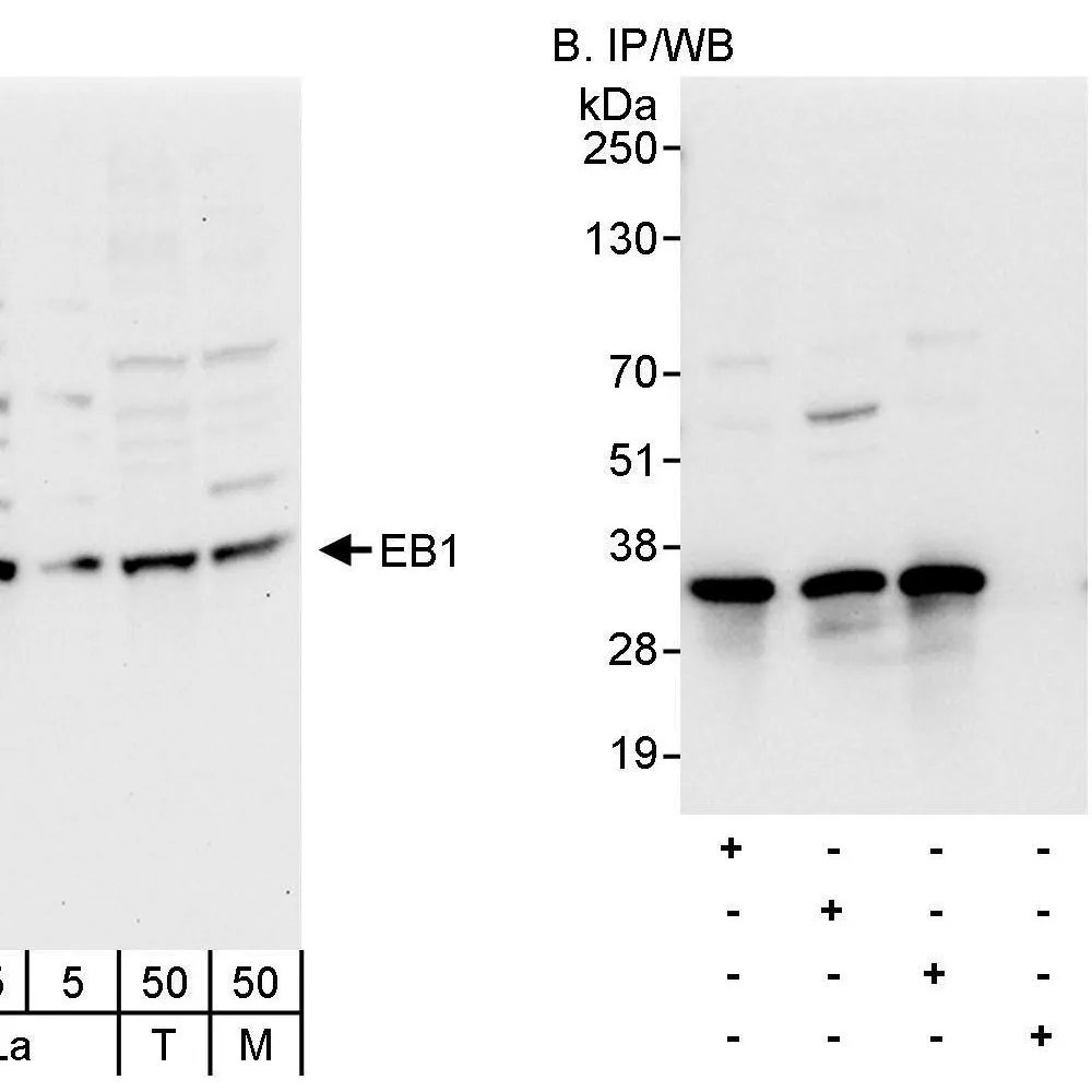 Rabbit anti-EB1 Antibody, Affinity Purified