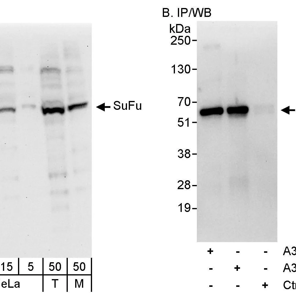 Rabbit anti-SuFu Antibody, Affinity Purified