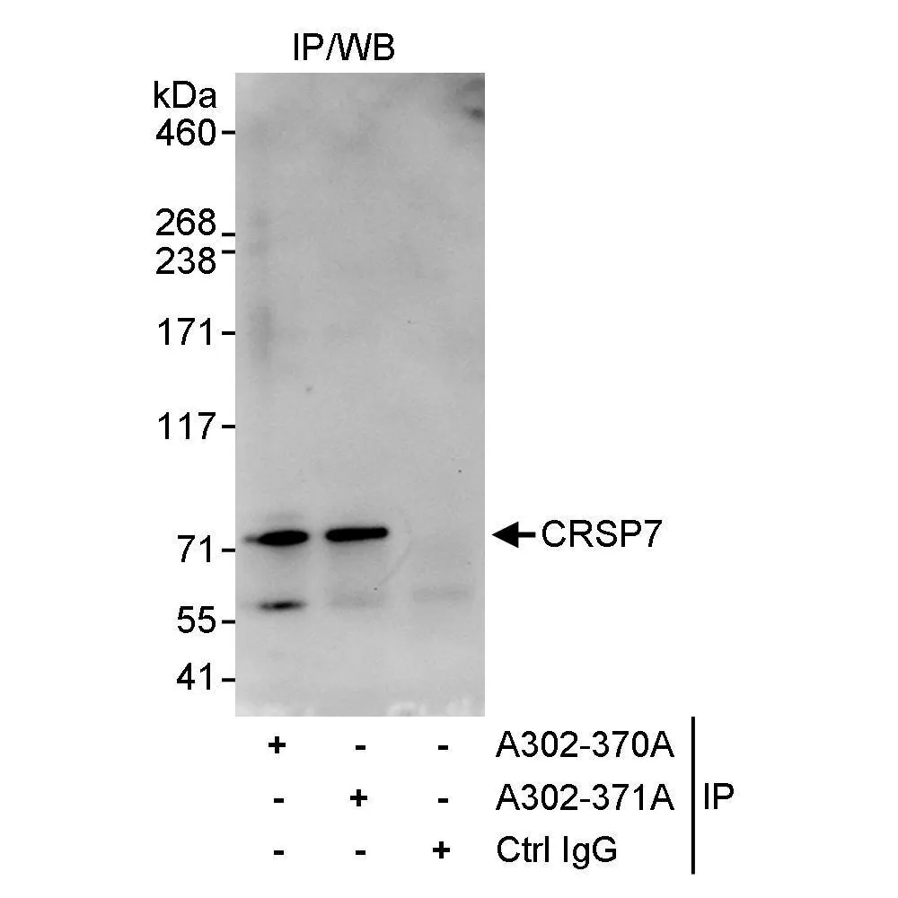 Rabbit anti-CRSP7 Antibody, Affinity Purified
