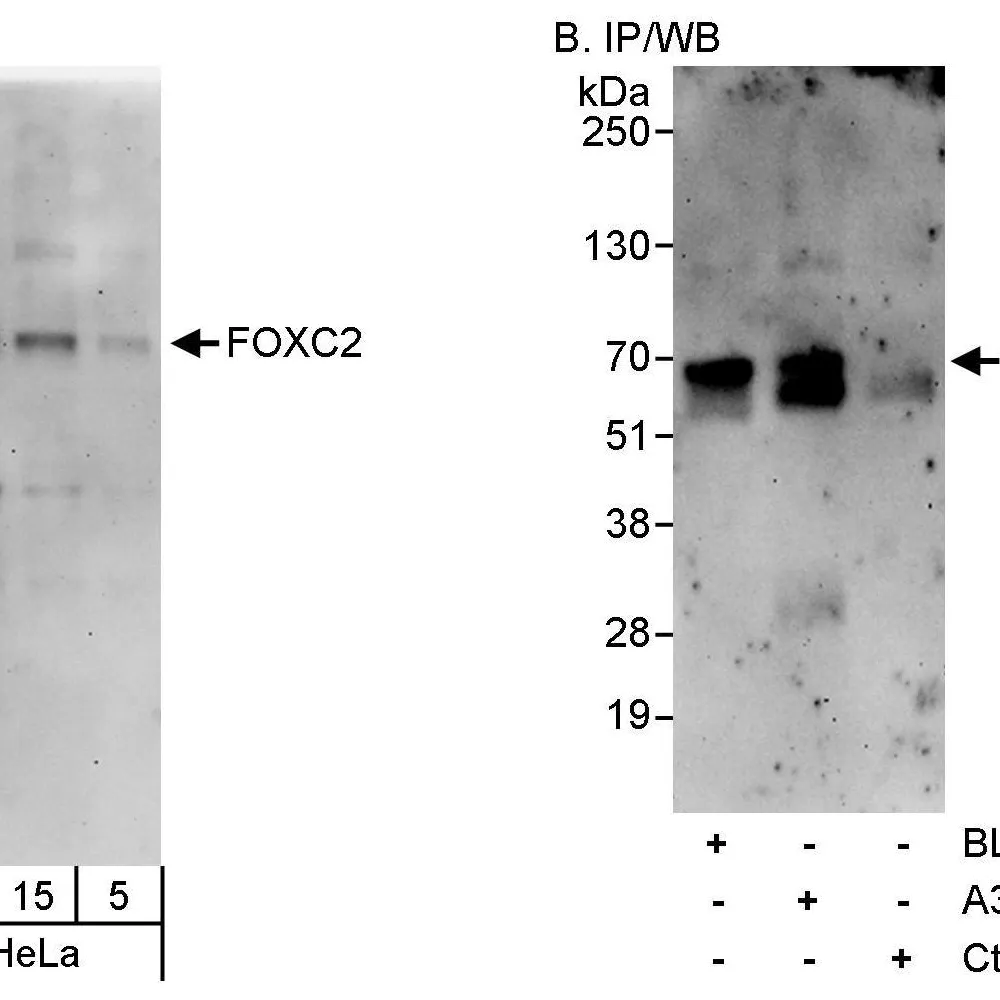 Rabbit anti-FOXC2 Antibody, Affinity Purified